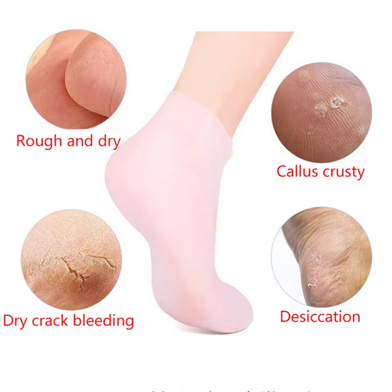 "Revitalize and Pamper Your Feet with Our Silicone Moisturizing Gel Heel Socks - Say Goodbye to Cracked Foot Skin and Cracking with This Spa-Like Feet Care Solution!"